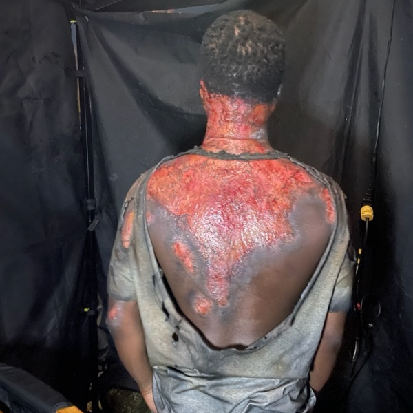 Draymond Back burn2_edited
