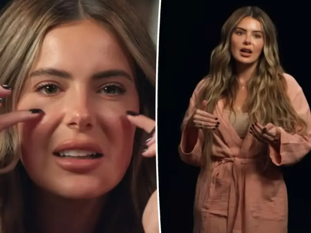 Kim Zolciak's Daughter Brielle Biermann Reveals Mother's Influence on Her 'Botched' Cosmetic Procedures