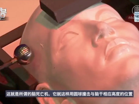 【解讀】連續換肺抗病毒，中共活摘產業鏈復活？王立軍發明腦幹撞擊機做啥？中國腦死器官供體為何多？（2020.3.3）