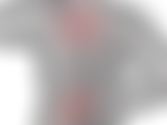 UTJECAJ ATLANTO-OKCIPITALNIH DISFUNKCIJA NA KOMPENZACIJSKE TENZIJE TIJELA