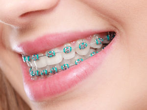 Orthodontics