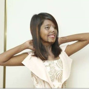 An acid attack survivor becomes a model !