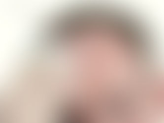 Bid Goodbye to Embarrassment with the Best Treatment for Sweaty Face