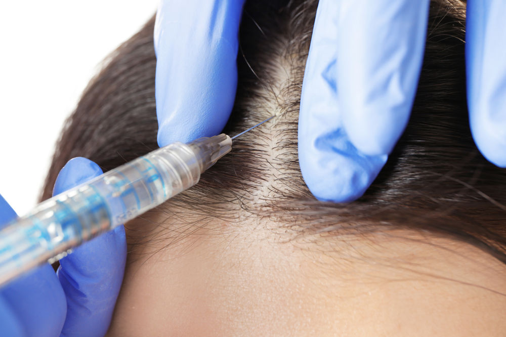 Dr CYJ Hair Filler Dr CYJ Hair Filler