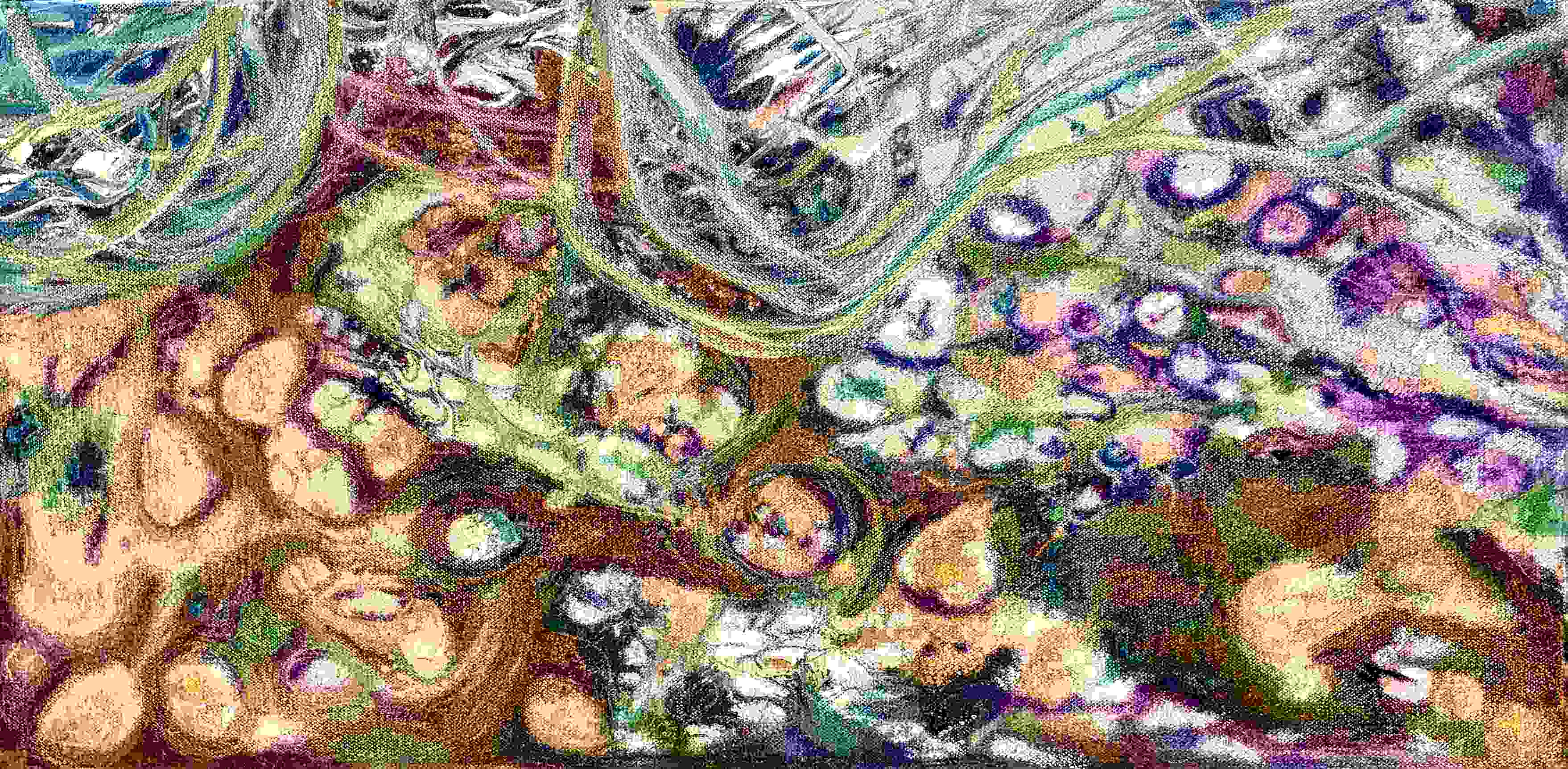 Underwater treasures