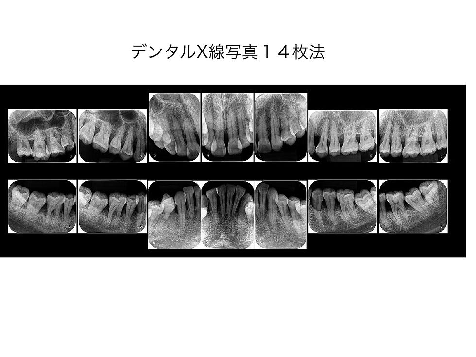 船橋市つかだ歯科医院 矯正症例