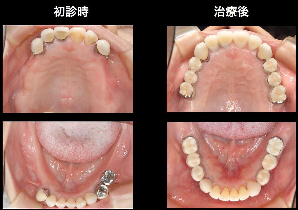 つかだ歯科医院　矯正歯科症例