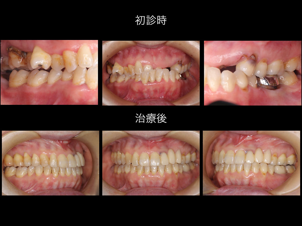 船橋市つかだ歯科医院　矯正症例