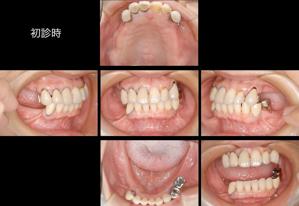 つかだ歯科医院　矯正歯科症例