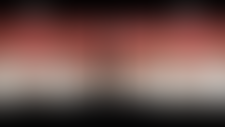 ダイレクトボンディング　（顕微鏡治療を用いたコンポジットレジン修復）