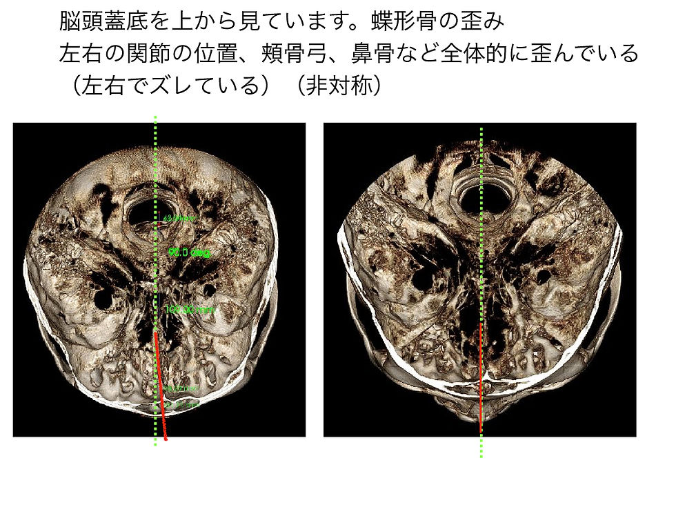 船橋市つかだ歯科医院　矯正症例