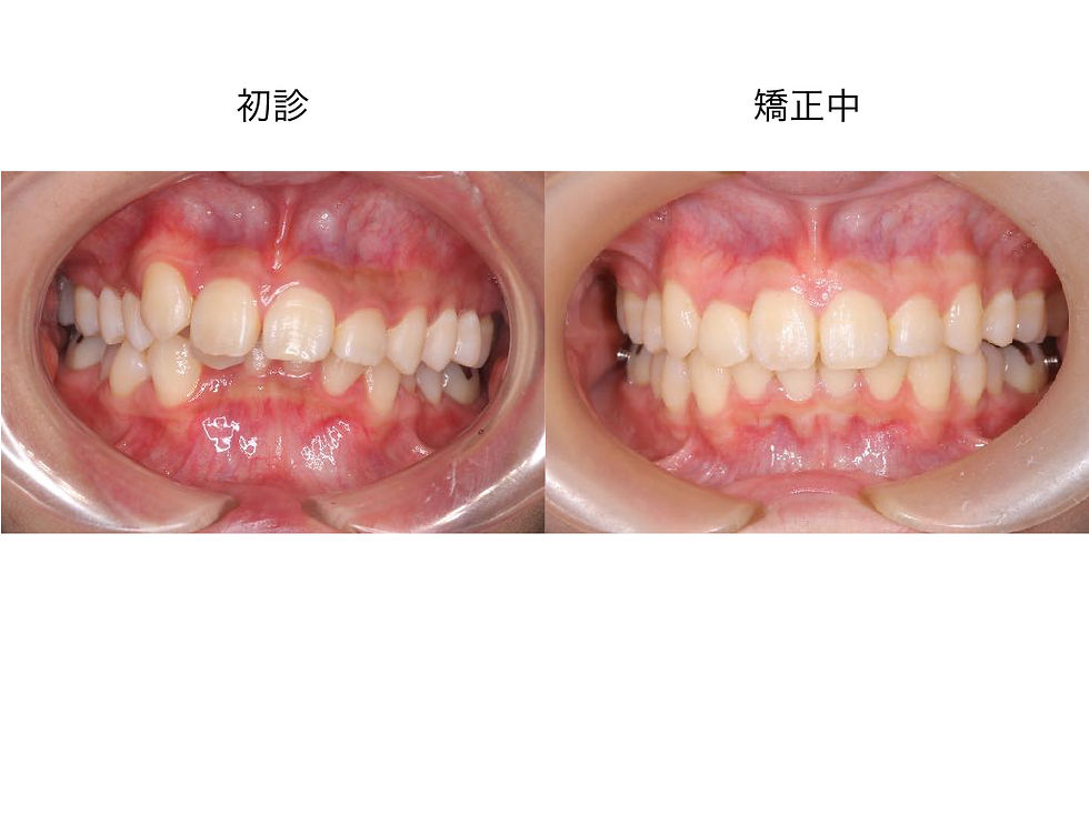 船橋市つかだ歯科医院　矯正症例