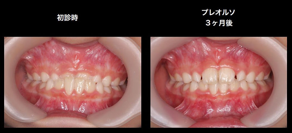 つかだ歯科医院　歯周病症例