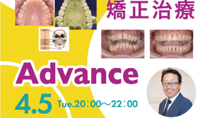 〈終了〉日常臨床におけるGPが押さえておきたい矯正治療 Advance（WEB講習会）