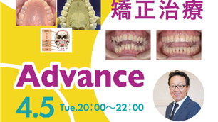 〈終了〉日常臨床におけるGPが押さえておきたい矯正治療 Advance（WEB講習会）