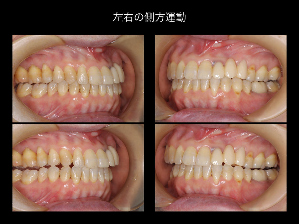 船橋市つかだ歯科医院　矯正症例