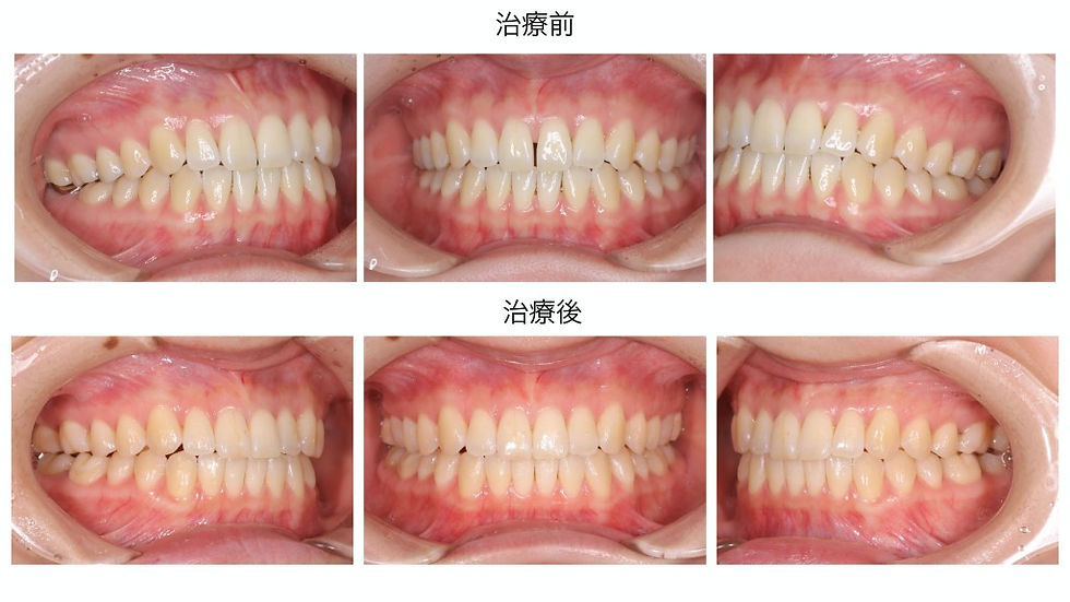 船橋市のつかだ歯科医院 咬合再構成