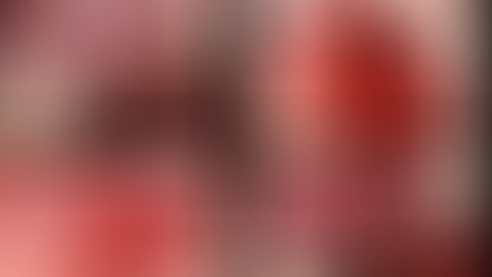 インプラント治療 上顎洞挙上術