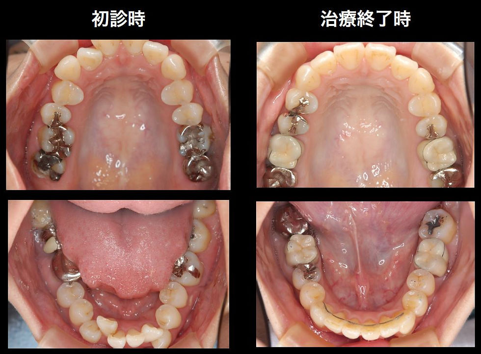 つかだ歯科医院　矯正歯科症例
