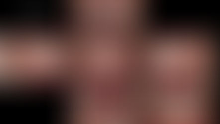 食いしばりで歯が痛い・噛み合わせが悪い(27歳・女性)