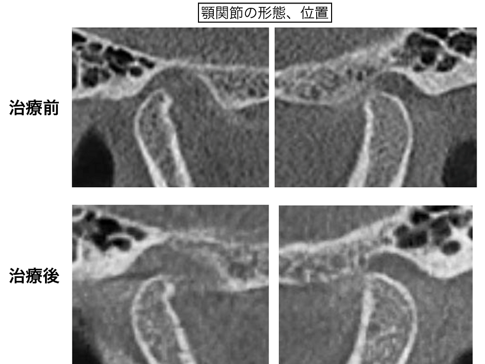 船橋市つかだ歯科医院　矯正症例