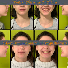 Un nuovo sorriso per S.: quando l’ortodonzia fa la differenza