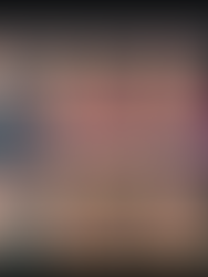 Premolare rotto. Veramente l'impianto è l unica scelta???