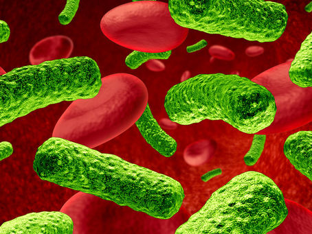 Recce Pharmaceuticals – working on the global health challenge of sepsis and superbugs