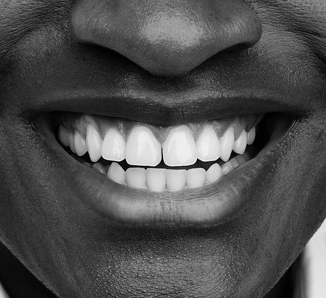 teeth.jpeg
