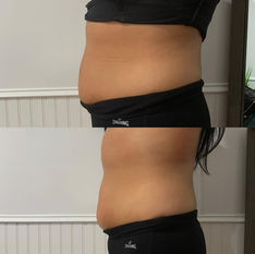 1-slimming-session.jpg