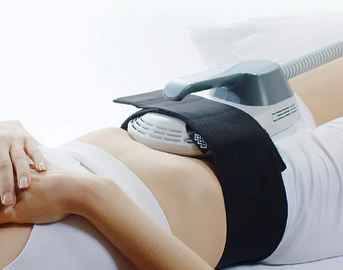 HIFEM muscle toning body contouring