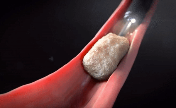 ezgif.com-video-to-gif (6).gif