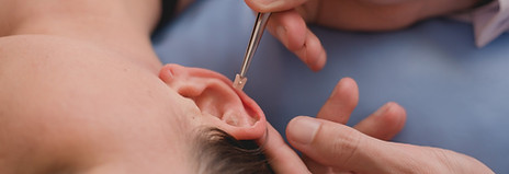 AURICULOTERAPIA.jpg