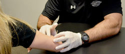 DRY NEEDLING