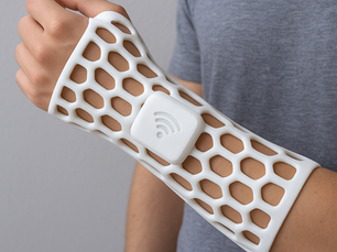 The Future of Plastering Broken Bones: Smart Casts and Beyond
