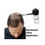 Thumbnail: HairFiller Sevich Hair Fibre Applicator