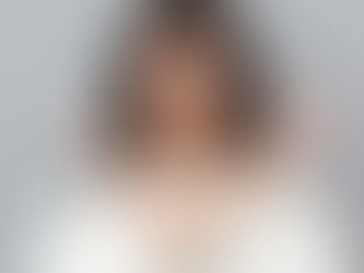 No cometas estos errores si tienes acné