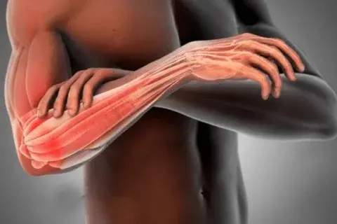 Tennis Elbow Treatment Dubai: Causes, Symptoms and Exercises