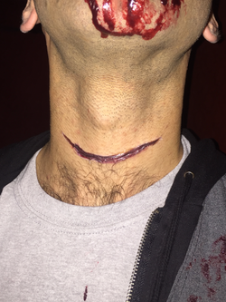Scar