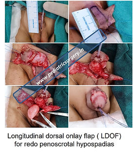 Tibbiy korikda azolarning erotik tekshiruvi Yosh qizlar bilan porno video