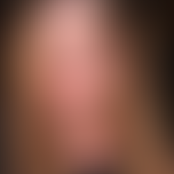 CARLA VASCONCELOS RELATA PROBLEMA DE SAÚDE