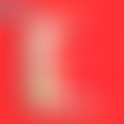 Grosse colère de Mireille d'Allancé