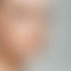 O ácido hialurônico é uma substância naturalmente presente no nosso corpo