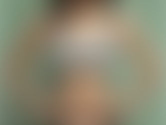 Lipocavitação: A Nova Solução para Gordura Localizada II