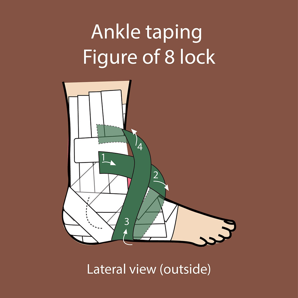 Ankle Taping for sprained ankle injury part 2 heel locks and figure