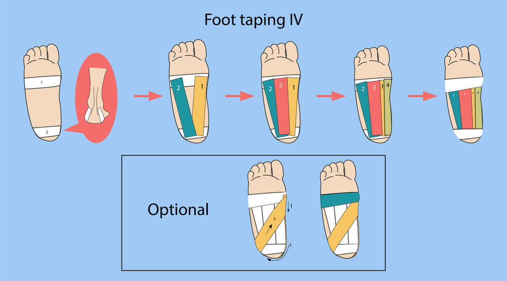 4 Ways of taping your foot plantar fasciitis or foot arch support