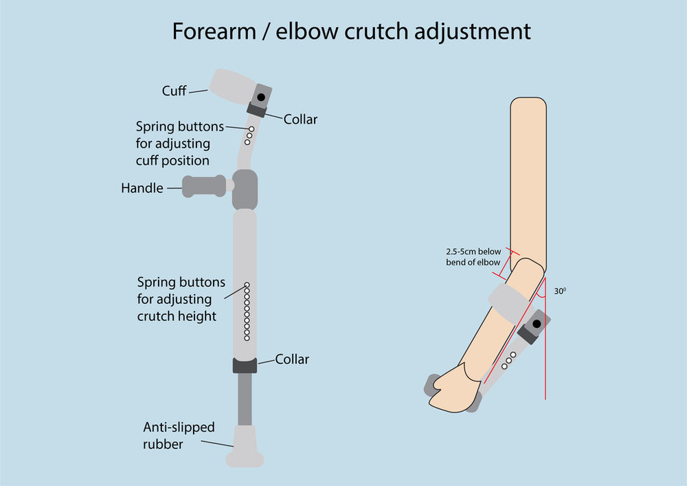 All you want to know about crutches forearm and underarm crutches