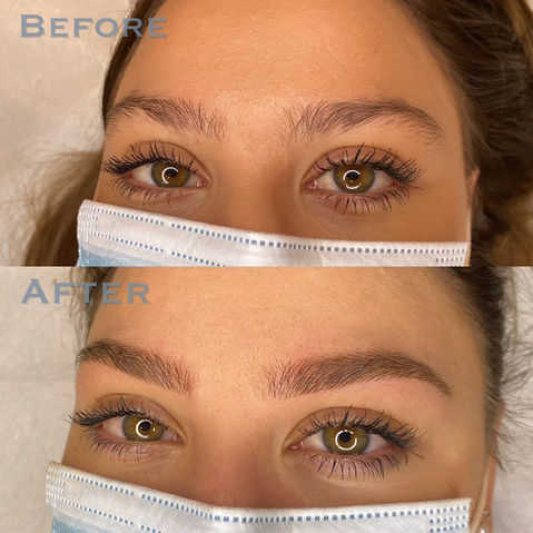 avant/après Sourcils poil à poil (microblading) 