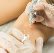 dermopigmentation réparatrice
