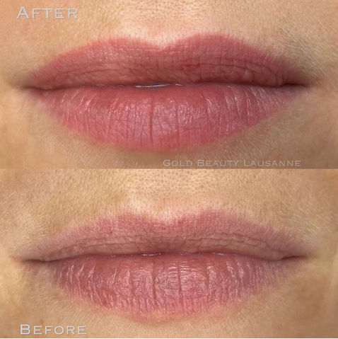 Maquillage permanent des lèvres, blush lips